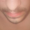 DurzoBlint